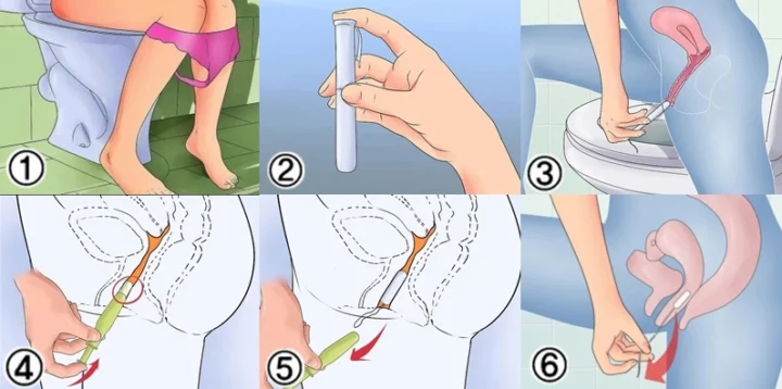 Hướng dẫn chi tiết cách sử dụng tampon an toàn và hiệu quả Các loại tampon trên thị trường