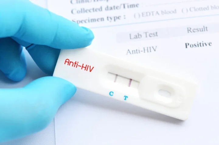Xét nghiệm HIV Bao nhiêu Tiền 2026? Cập Nhật Chi Phí Mới Nhất Các phương pháp xét nghiệm HIV