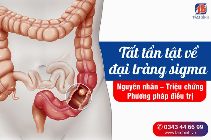 Cấu tạo đại tràng sigma
