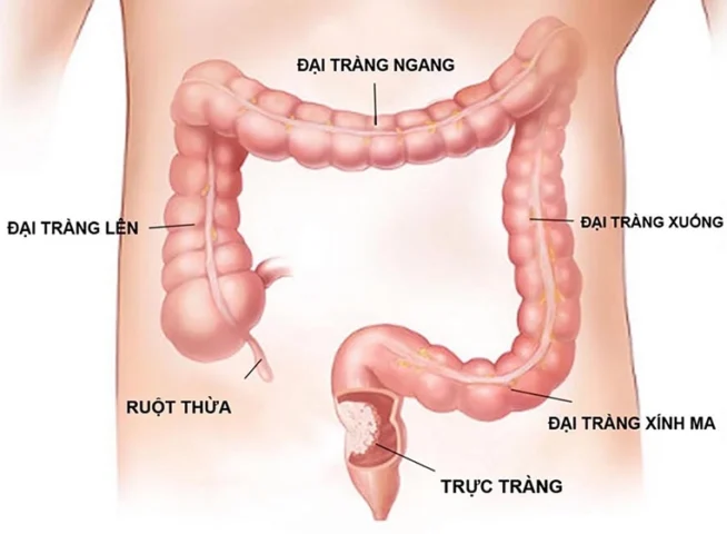Cấu tạo và vị trí của đại tràng trong hệ tiêu hóa