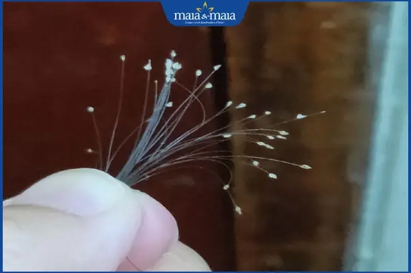 Da đầu sạch gàu và khỏe mạnh sau điều trị