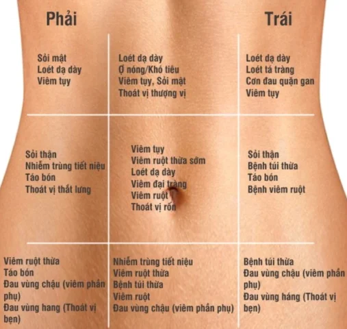 Hình ảnh minh họa cơn đau bụng quanh rốn