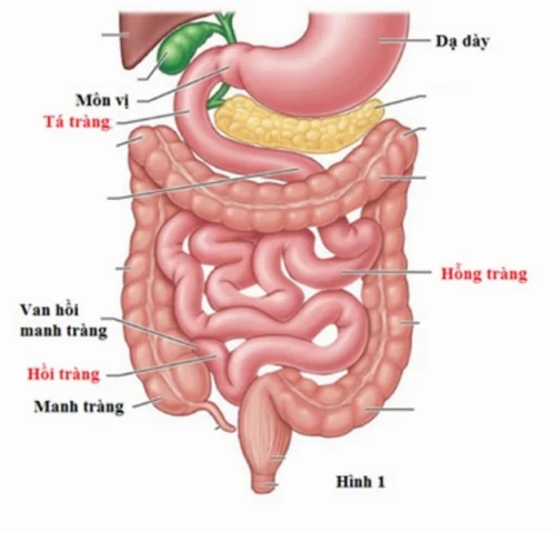 Hình ảnh minh họa hồi tràng bị viêm