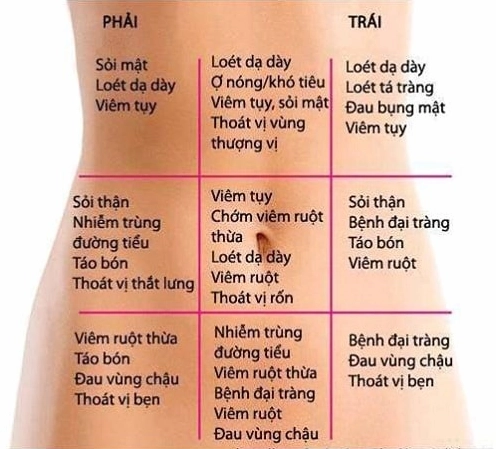 Hình ảnh minh họa nguyên nhân đau bụng quanh rốn