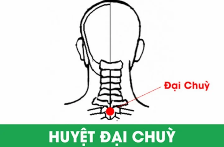 Huyệt Đại Chùy: Bí Mật Chữa Bách Bệnh Từ Cổ Họng