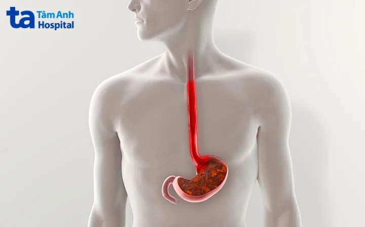 Minh họa quá trình thức ăn di chuyển qua thực quản