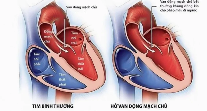 Động Mạch Chủ: Cấu tạo, Chức năng và Các Bệnh Lý Liên Quan