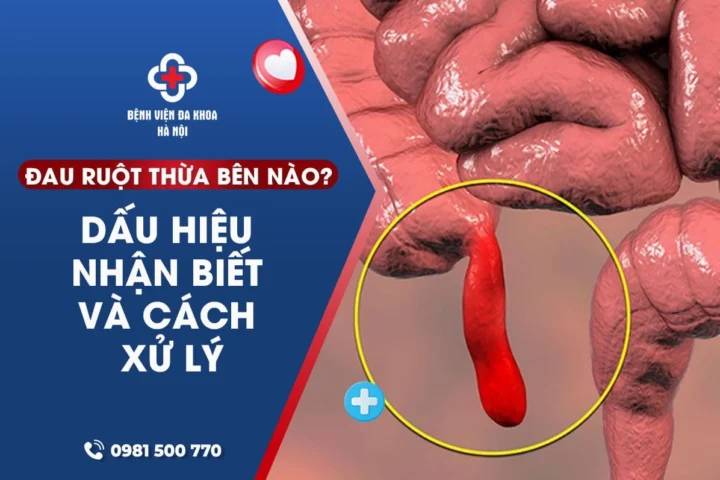 Ruột thừa nằm ở đâu? Giải đáp chi tiết và cập nhật 2026