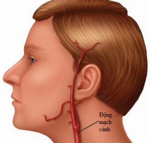 Động Mạch Cảnh: Vai Trò, Cấu Tạo Và Bệnh Lý Liên Quan Sơ đồ cấu tạo động mạch cảnh
