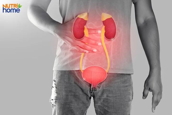 Đau Thận Ở Vị Trí Nào? Dấu Hiệu và Cách Nhận Biết Chính Xác Tổng quan về tình trạng đau thận