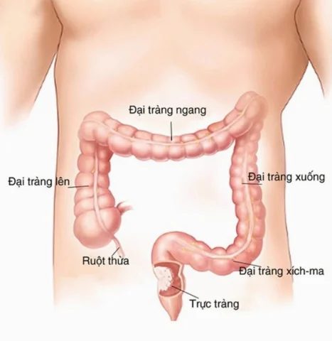 Vị trí đại tràng sigma trong hệ tiêu hóa