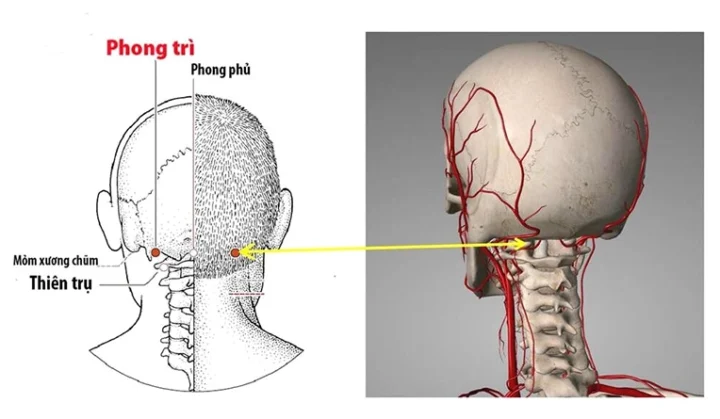 Vị trí huyệt Phong Trì trên cổ