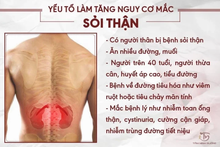 Yếu tố nguy cơ hình thành sỏi thận